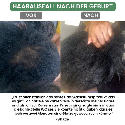 Batana Natürliches Haarwuchsöl